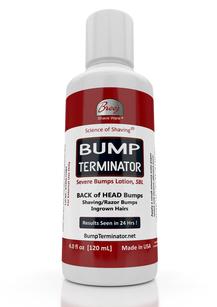 2019 year - How to treat bumps in men after shaving 2019 year