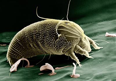 Dust Mite Dust Mite