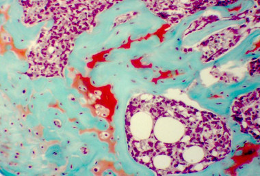 NovaUltra Safranin O Stain Kit - IHC World Online Store