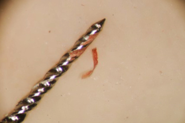 Close Up View of GP and Rotary File