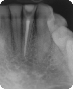 Final Postoperative Radiograph