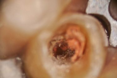 Close Up View