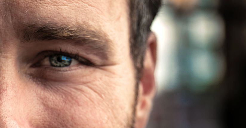 Traumatic Brain Injury and Dry Eye Traumatic Brain Injury and Dry Eye