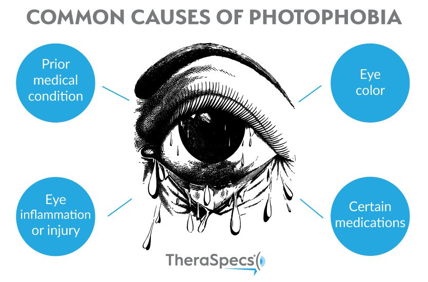 common causes of photophobia