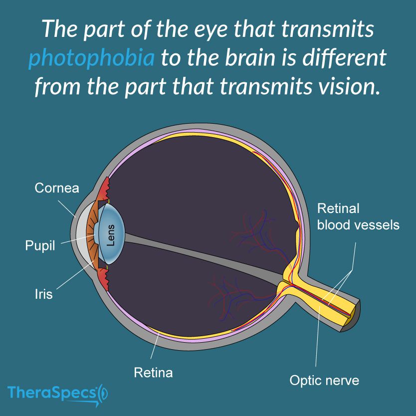 The Ultimate Guide to Photophobia and Light Sensitivity