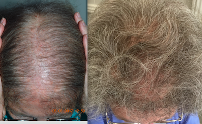 help-hair-shake-and-help-hair-vitamins.png help-hair-shake-and-help-hair-vitamins.png