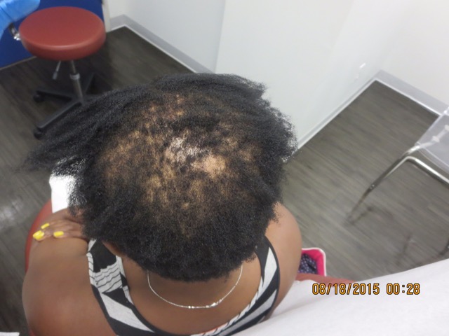 Is My Natural Hair Products Breaking My Hair Off Is My Natural Hair Products Breaking My Hair Off