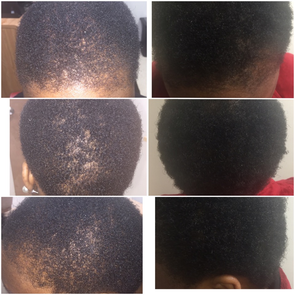 Black Hair Care Products Black Hair Growth Products African