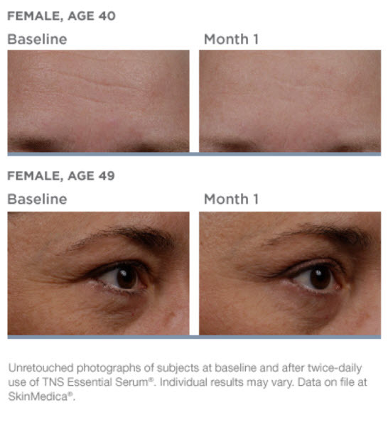 tns-before-after-65148.1458163797.1280.1280.jpg tns-before-after-65148.1458163797.1280.1280.jpg