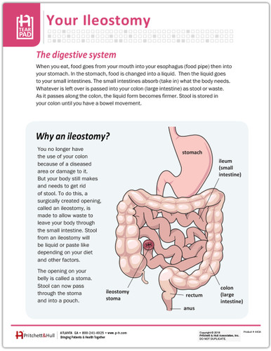 Your ileostomy Tearpad (50 sheets per pad) - Pritchett and Hull