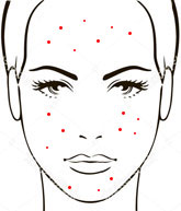 Acne-Prone Skin Type